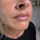 ombre lips